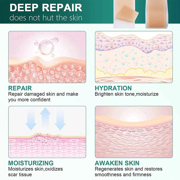 1roll Reusable Professional Silicone Scar Strips for Keloid