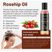 250ml Rosehip Coconut Oil for Skin Care Massage Base