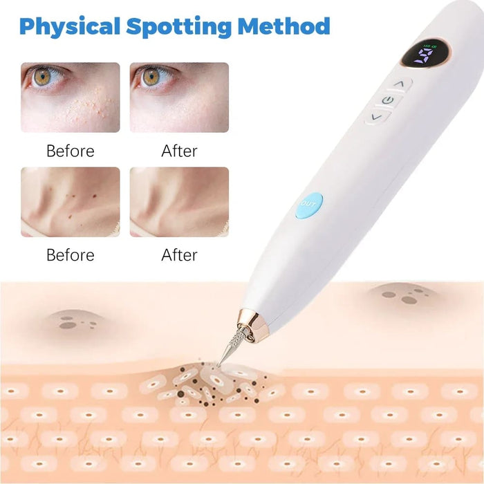 9 Mode Lcd Mole Removal Pen for Tattoo Freckle Dark Spot