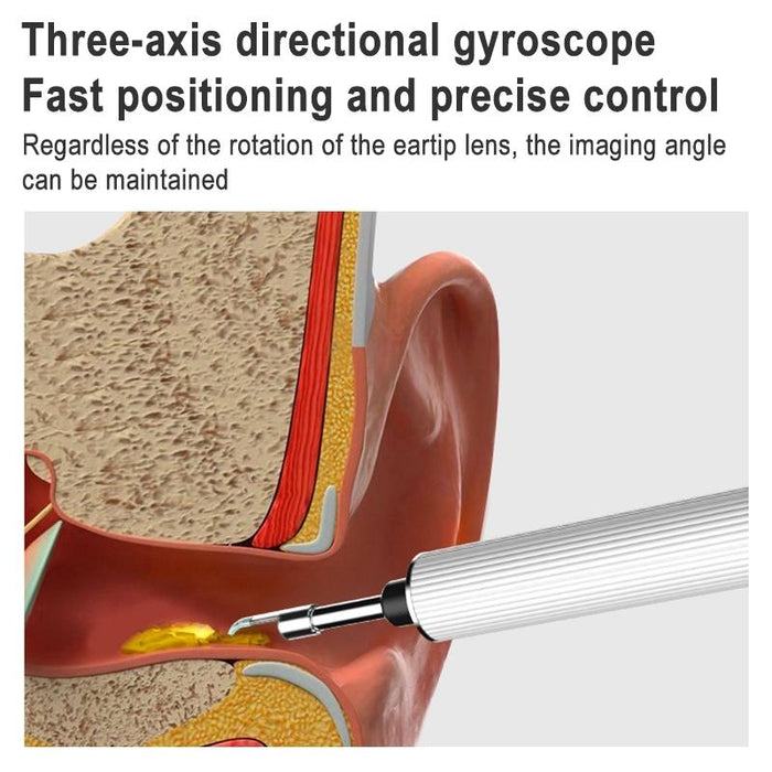 Portable Smart Earpick For Earwax Removal Black