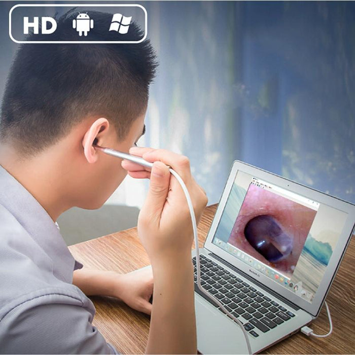 1Mp Hd Visual Ear Nose Tooth Endoscope Borescope With 6 Leds Lens Diameter 4.3Mm