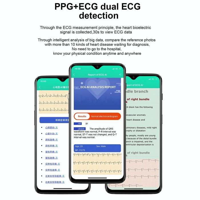 1.7 Inch Tft Colour Screen Ip68 Waterproof Smart Watch Support Blood Oxygen Monitoring / Body Temperature Monitoring / Ai Medical Diagnosis - Leather Strap