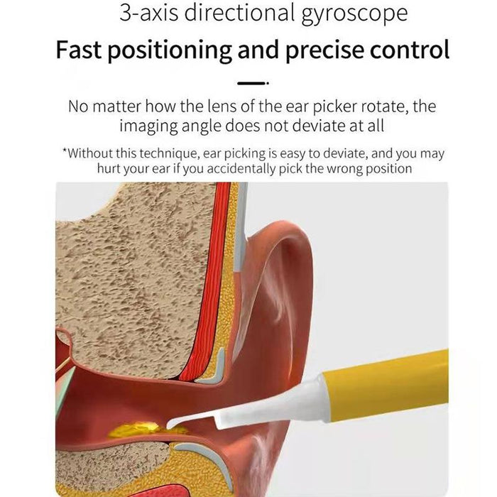 Smart Wireless Earpick For Easy Earwax Removal