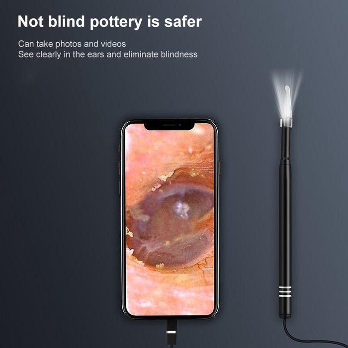 Smart Hd 5.5Mm Visual Earpick 3 In 1 Not Compatible Random Colour