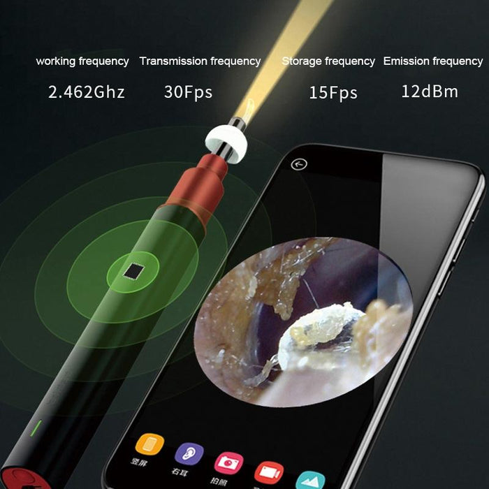 Intelligent Hd Ear Cleaner Standard Version