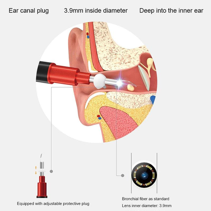 Intelligent Hd Ear Cleaner Standard Version