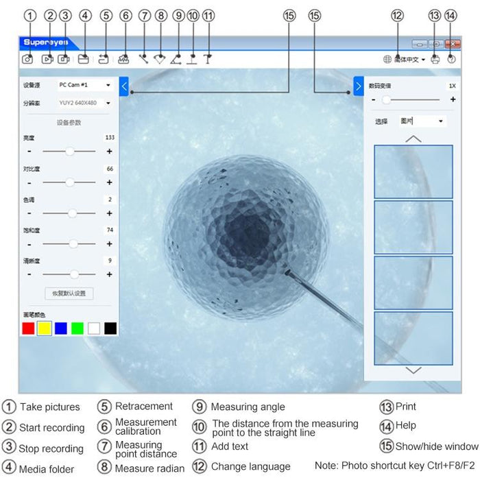 Wireless Digital Ear Nose Mouth Endoscope