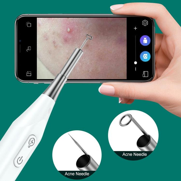 Microscopic Ear Pick With Magnifying Mirror