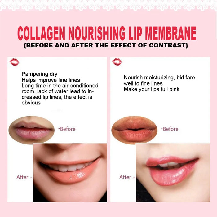 5 / 10 / 20 Piece Hydrating Lip Plumper Mask