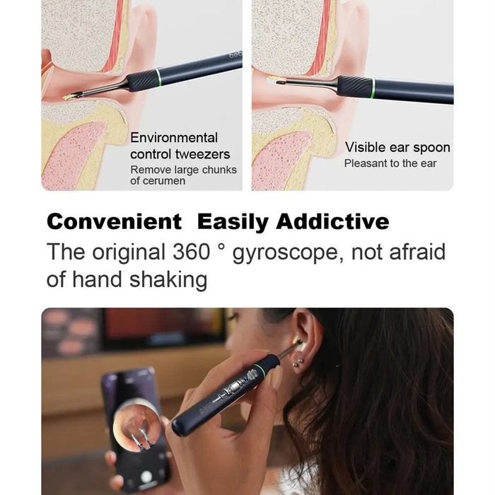 Smart Ear Cleaner with Hd Endoscope and Tweezers