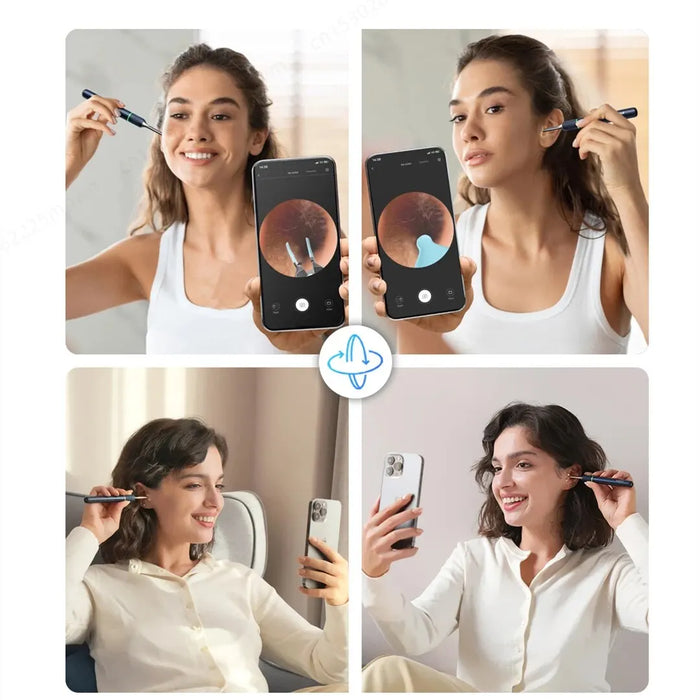 Smart Ear Cleaner with Hd Endoscope and Tweezers