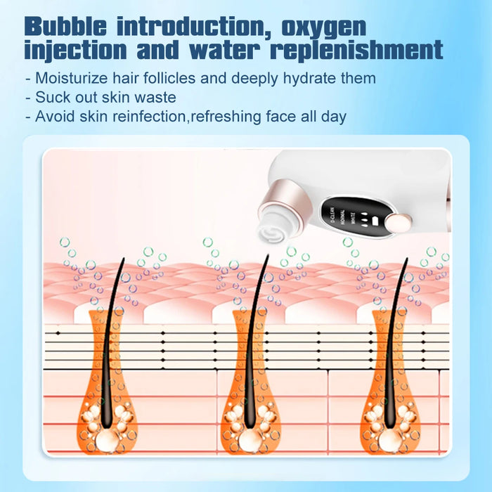 Rechargeable Blackhead Vacuum For Clear Skin