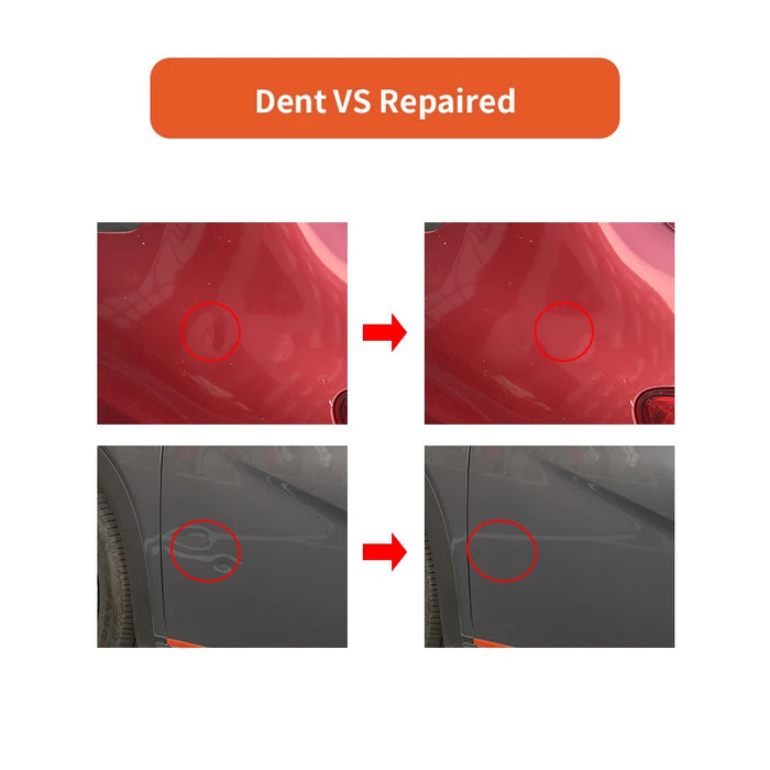 Car Dent Puller Kit Hail Damage Repair Tool Set