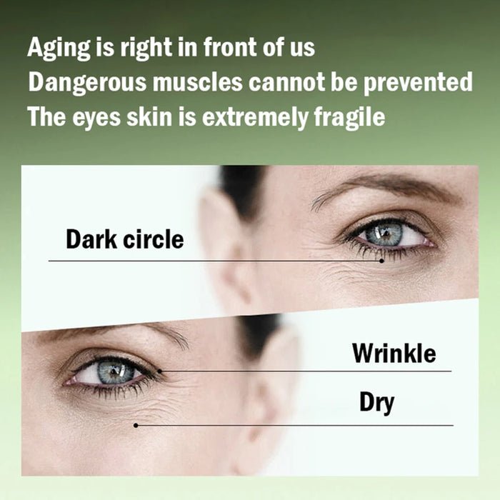 60 Piece Anthocyanin Lutein Eye Mask For Dark Circles & Anti Aging