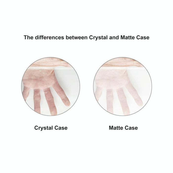 For Macbook Air 13.6 2022 / 2024 A2681 M2 / A3113 M3 Eu Version 3 In 1 Matte Laptop Case With Tpu Keyboard Film / Anti-Dust Plugs