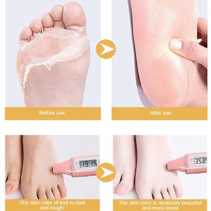 Goat Milk Exfoliating Foot Mask 5 Pairs