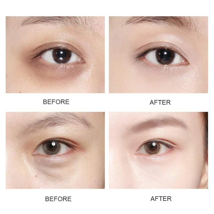 Crystal Gold Eye Patches Anti Dark Circles & Eye Bags