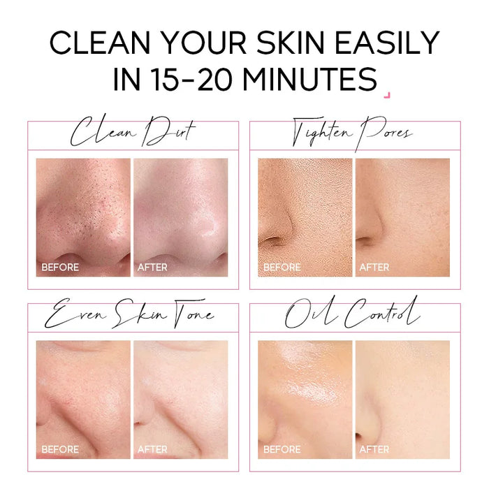 Vitamin C Gold Peeling Face Mask Blackhead Removal