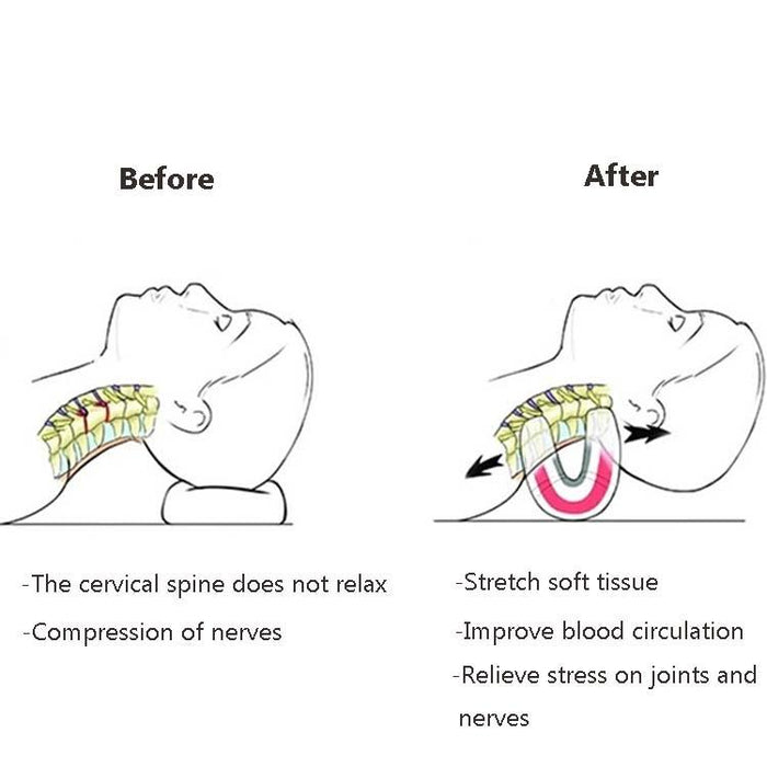 Portable Neck Pillow For Cervical Spine Stretching Massager Orthosis