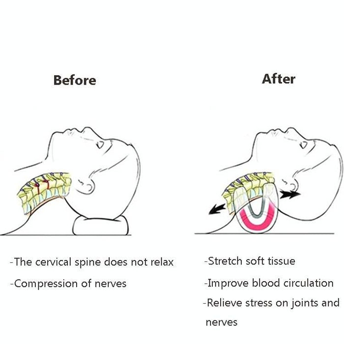 Portable Neck Pillow For Cervical Spine Stretching Massager Orthosis