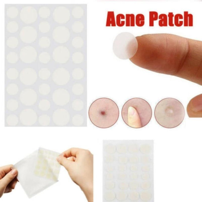 3 Pcs Acne Tool Set Treatment Acne Scar Pimples Sticker