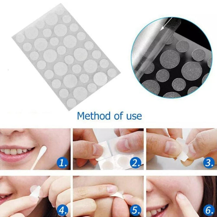 3 Pcs Acne Tool Set Treatment Acne Scar Pimples Sticker