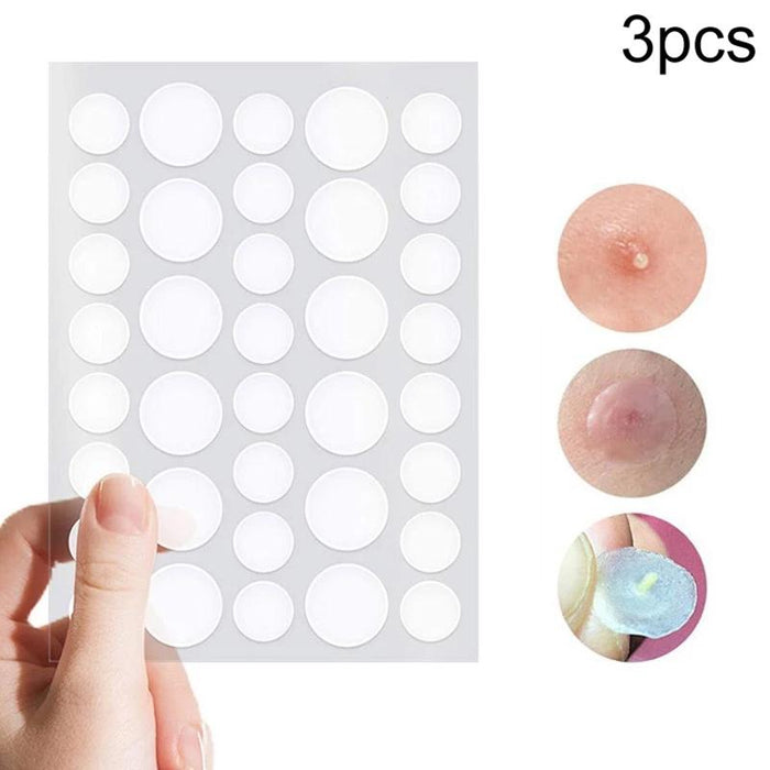 3 Pcs Acne Tool Set Treatment Acne Scar Pimples Sticker