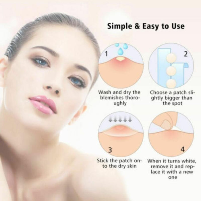 3 Pcs Acne Tool Set Treatment Acne Scar Pimples Sticker