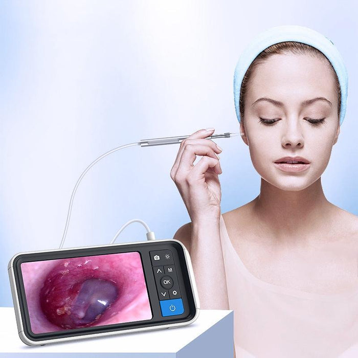 4.5 Inch Smart Hd Otoscope With 32Gb Memory Card