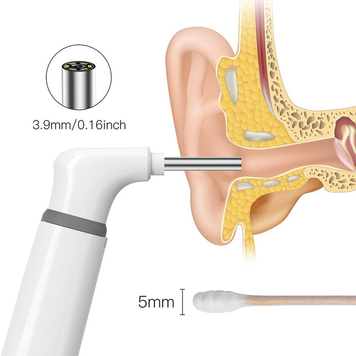 3.9Mm Wifi Ear Scope With Smart Visual Lens