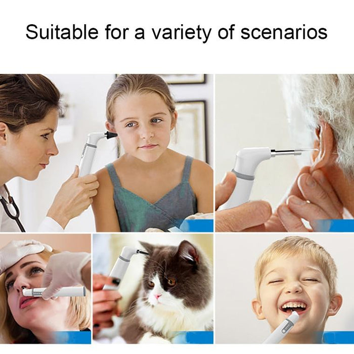 3.9Mm Wifi Ear Scope With Smart Visual Lens