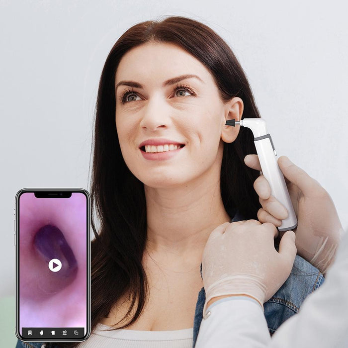 3.9Mm Wifi Ear Scope With Smart Visual Lens