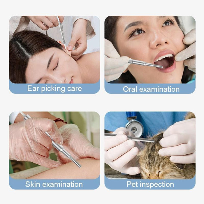 5 Inch Hd Ear Pickers With Illuminated Screen 3.9Mm Diameter