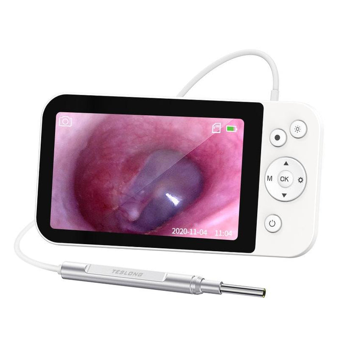 5 Inch Hd Ear Pickers With Illuminated Screen 3.9Mm Diameter