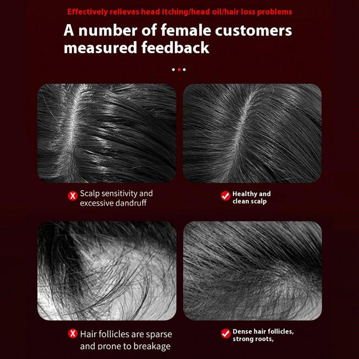 Red Light Scalp Massage Comb For Hair Growth 630Nm Liquid Care