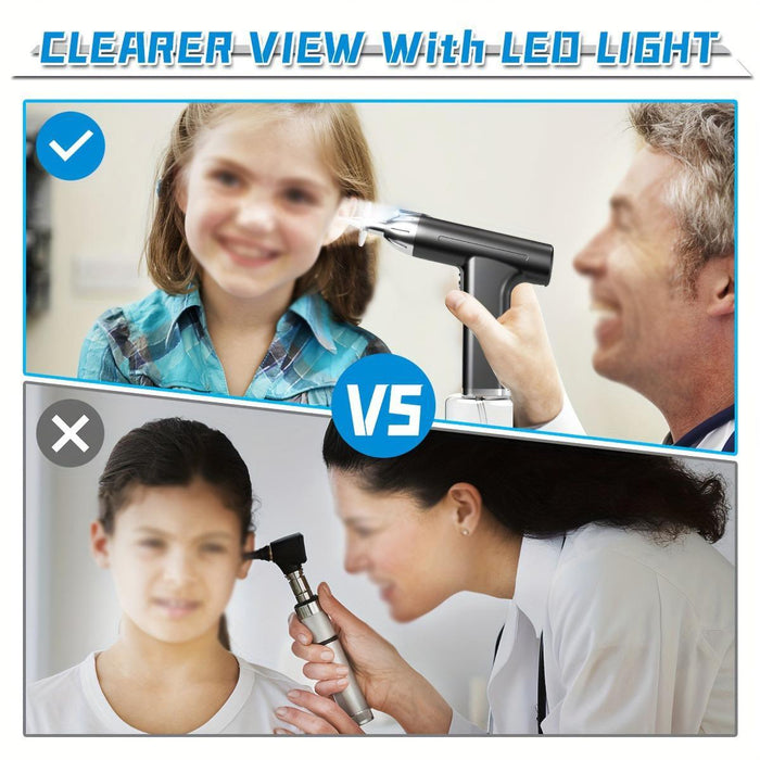 Rechargeable Earwax Remover With Led Light