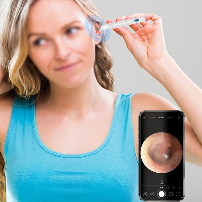 Smart Wifi Ear Picker With P3 Led & App