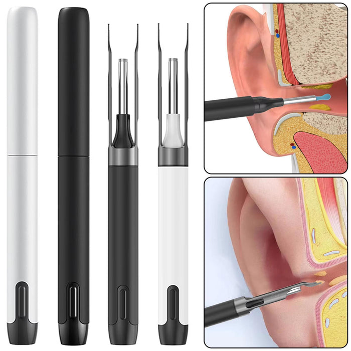10Mp Hd Detachable Ear Spoon With Smart Wifi & App
