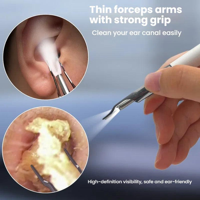 10Mp Hd Detachable Ear Spoon With Smart Wifi & App