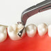 Contoured Matrix System for Dentists