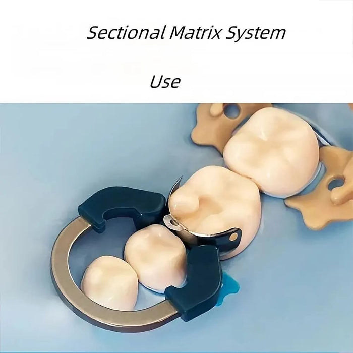 Contoured Matrix System for Dentists